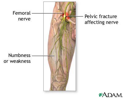 Tibial Nerve Dermatome. dermatome nerve lateral It